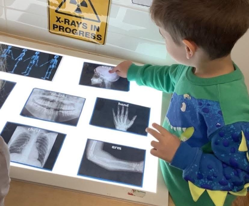 Exploring techology in X Rays